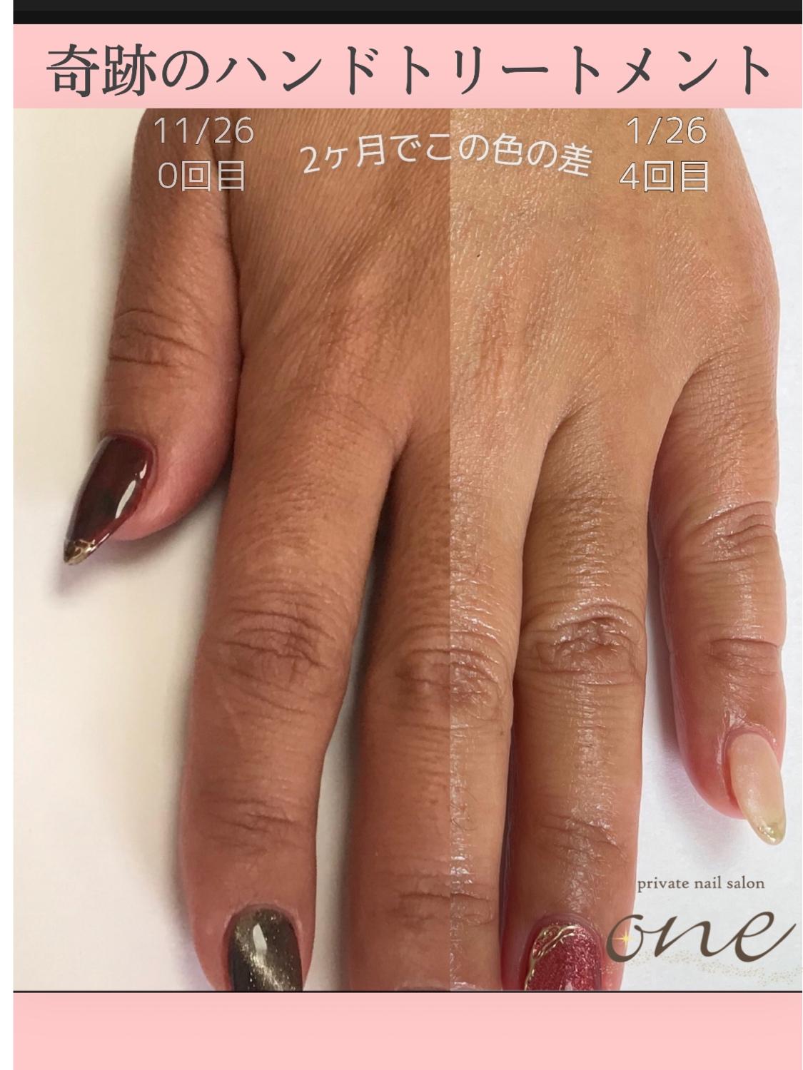 奇跡のハンドトリートメント